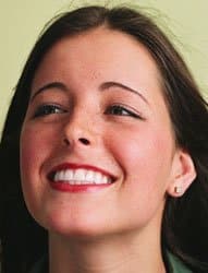 cosmetic bonding in tempe az
