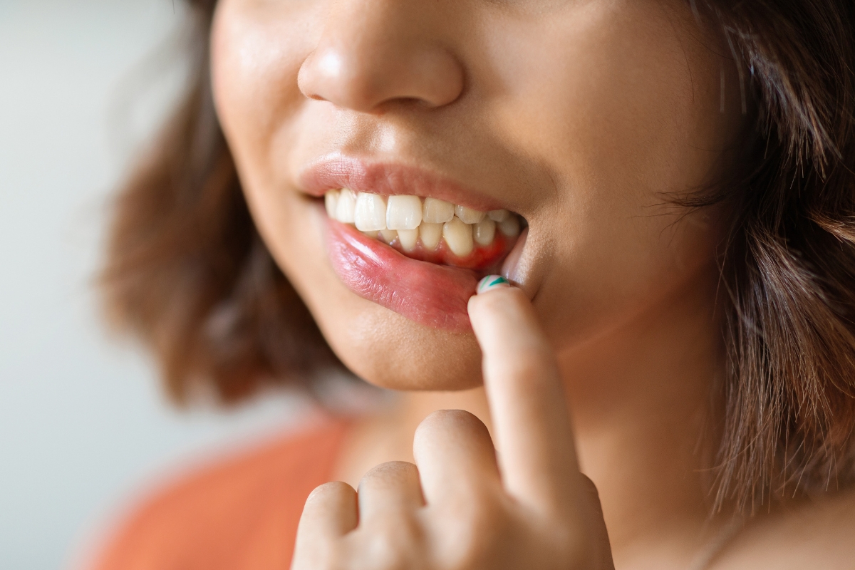 Gum Disease & Gingivitis Symptoms, Causes, and Treatment Options