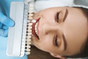veneers in tempe