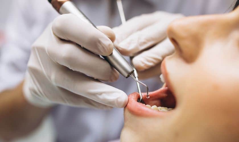 Cracked Teeth Treatment in Tempe
