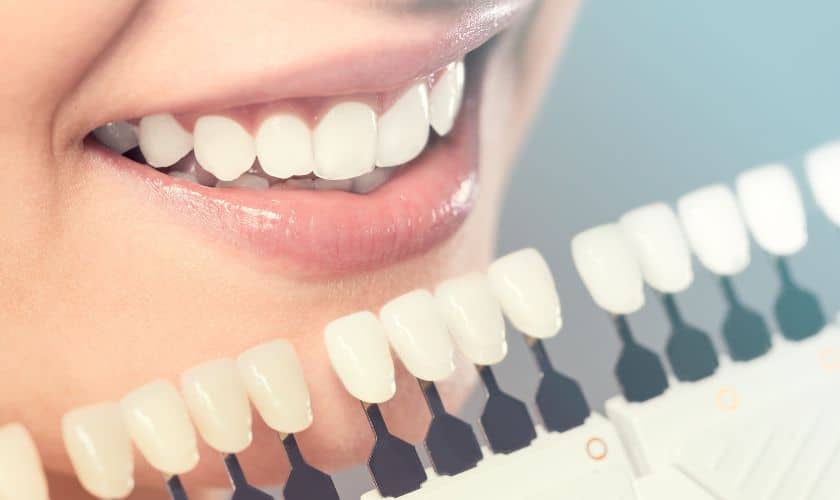 Cosmetic Dentistry in Tempe, AZ