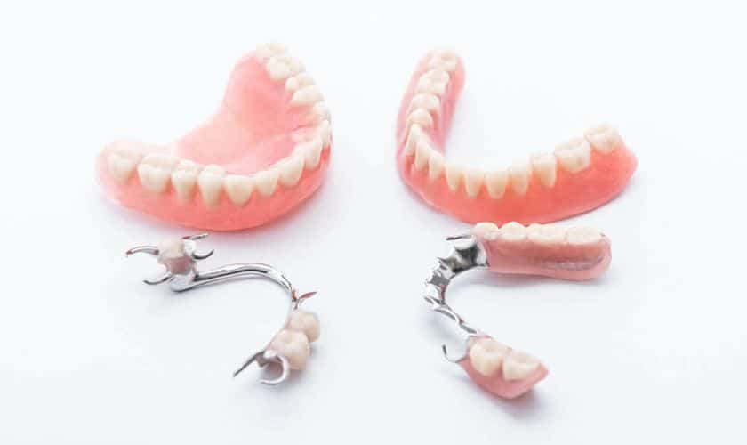 "Patient visits at Okun Dentistry in Tempe, AZ, for Denture Treatment."