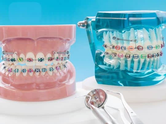 Our Orthodontist Tempe takes care on orthodontics treatment at Okun Dentistry