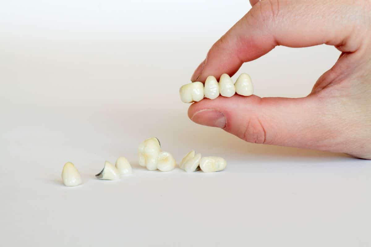 Dental Crowns in Tempe