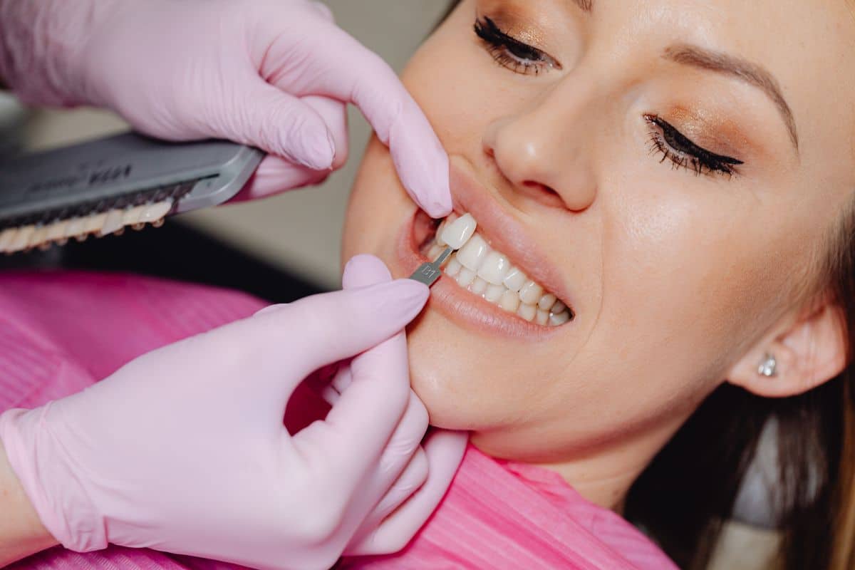 Veneers in Tempe