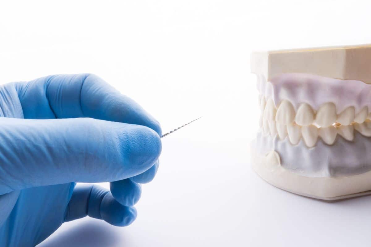 Endodontic Retreatment in Tempe