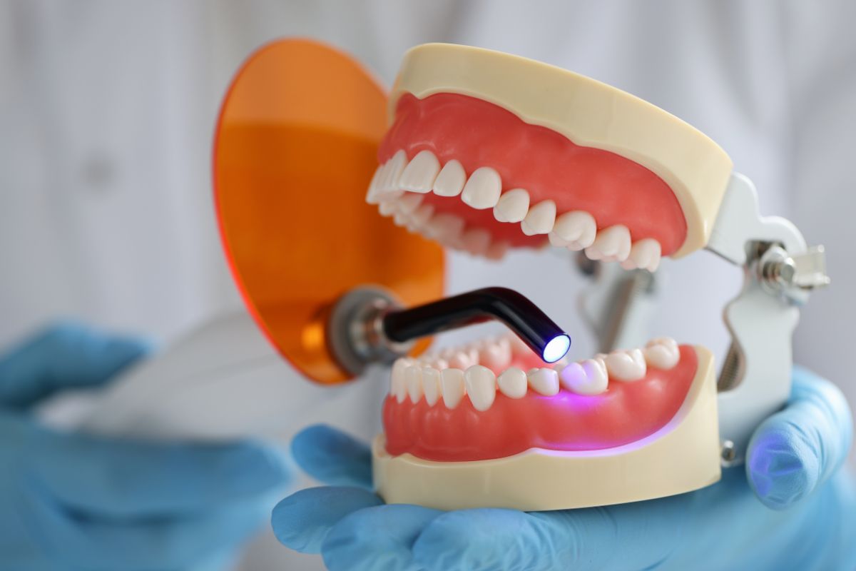 Dental Fillings in Tempe