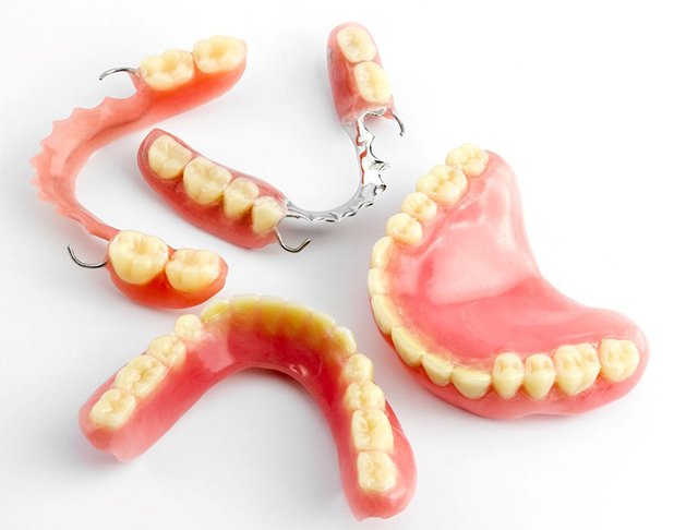 Dental prosthetics display including dentures, partial dentures, and connectors showing restorative dentistry options.