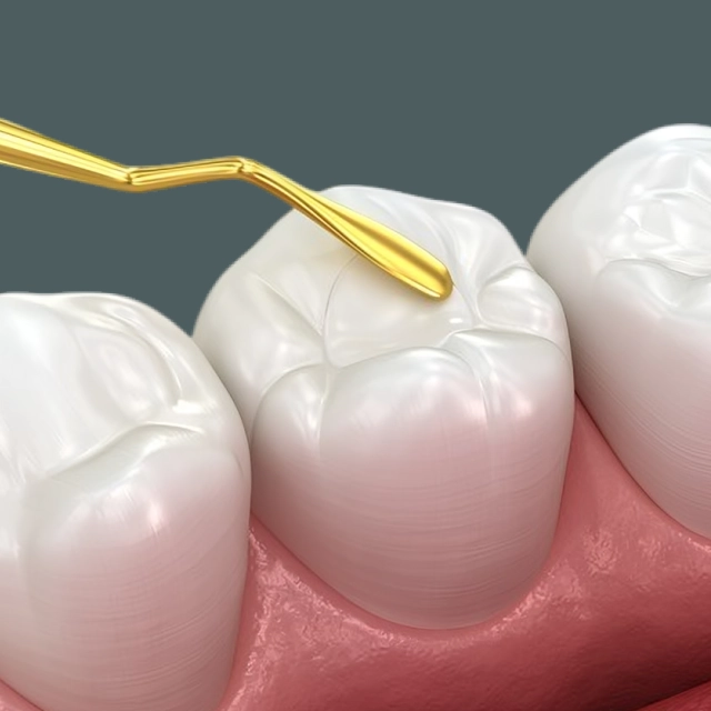 Dental tool examining tooth model showing gum health and tooth structure in clinical setting.