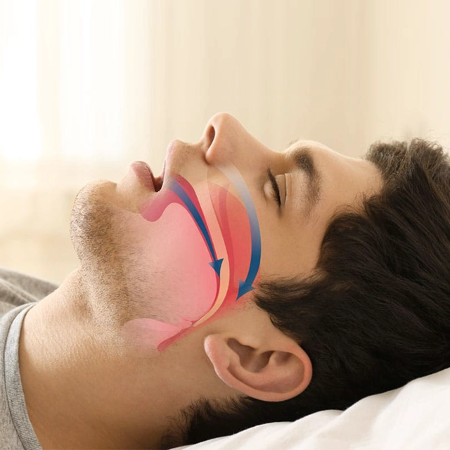 Man lying down with illustrated jaw and airway diagram overlay showing dental/sleep apnea treatment visualization.