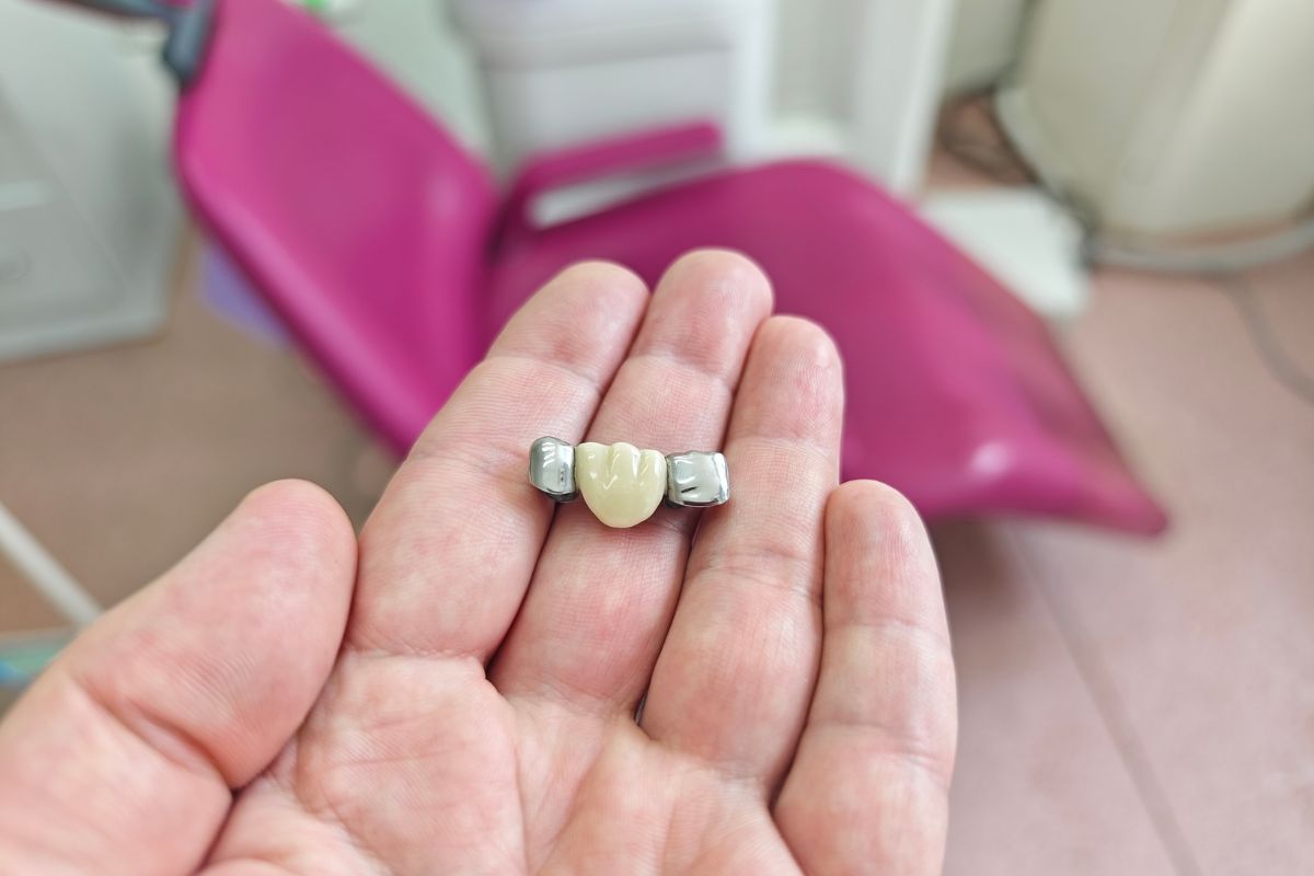Dental Crowns in Tempe