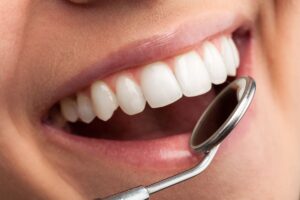Dentist in Tempe