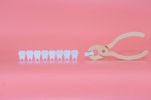Wisdom Tooth Extraction