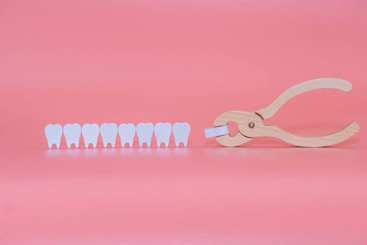Wisdom Tooth Extraction