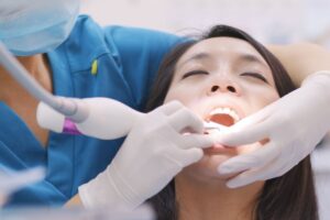 Root Canal Therapy in Tempe
