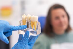 Dental Implants in Tempe