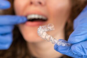 Invisalign