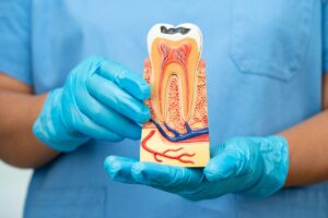Avoid These Foods to Prevent Tooth Decay A Dental Expert’s Guide