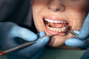 How Cosmetic Dentistry Helps Tempe Residents Smile Confidently