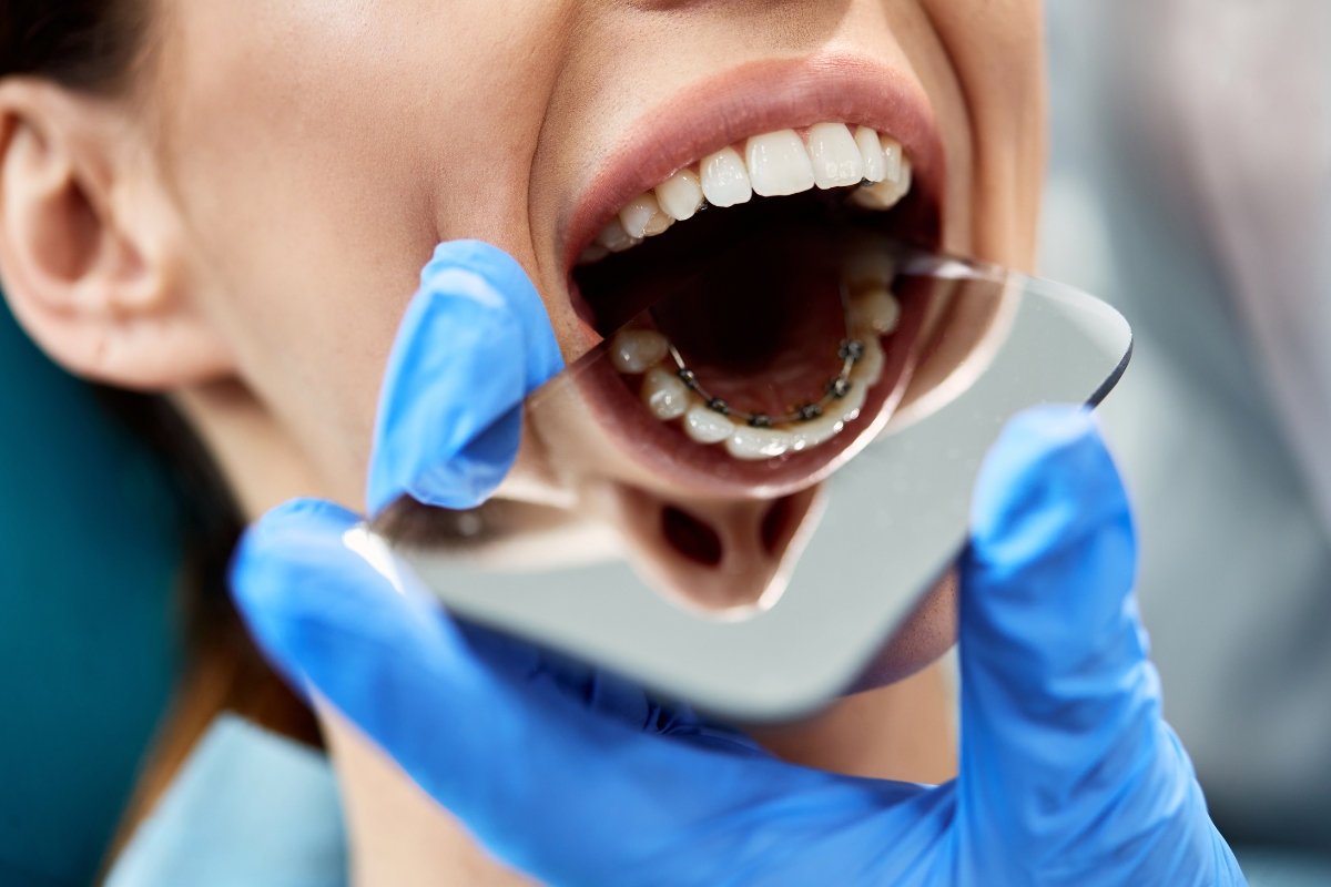 How to Choose the Right Orthodontist for Your Smile